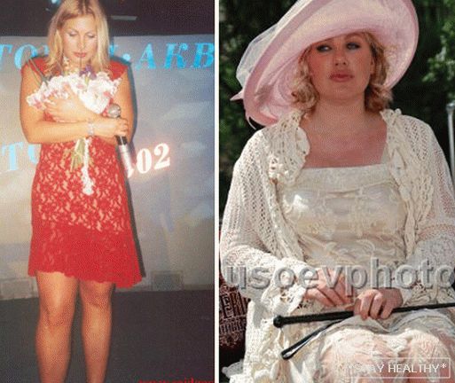 5 спявачак, якія моцна распаўнела