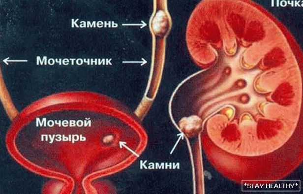 Дыета пры МКБ нырак